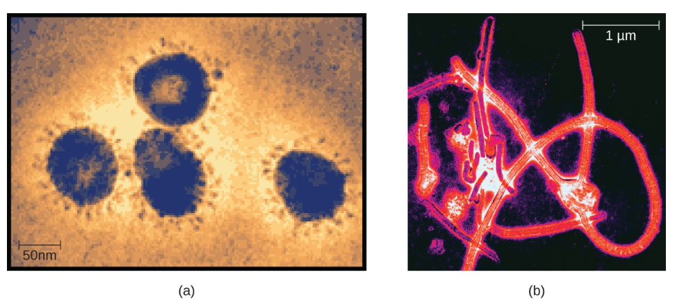 Hình 9. (a) Các thành viên của gia đình Coronavirus có thể gây nhiễm trùng đường hô hấp như cảm lạnh thông thường, hội chứng hô hấp cấp tính nặng (SARS), và hội chứng hô hấp Trung Đông (MERS). Ở đây chúng được xem dưới kính hiển vi điện tử truyền (TEM). (b) Ebolavirus, một thành viên của họ Filovirus, được hình dung bằng TEM. (tín dụng a: sửa đổi công việc của Trung tâm Kiểm soát và Phòng ngừa Dịch bệnh; tín dụng b: sửa đổi công việc của Thomas W. Geisbert)